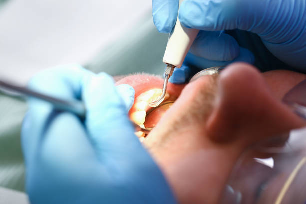 Best Urgent Tooth Repair  in Lake Forest, IL