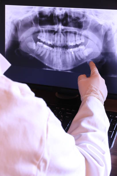 Best Broken Tooth Emergency  in Lake Forest, IL